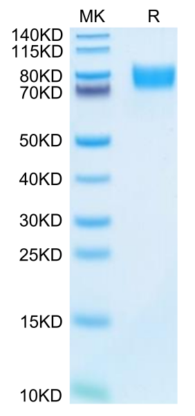 Mouse ALCAM/CD166 Protein