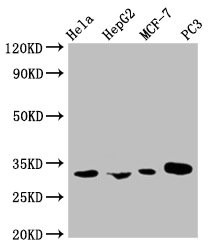 Anti-AGBL2 Monoclonal, clone 1F3C12