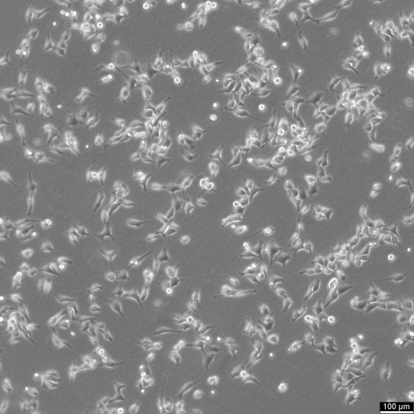 HK EGFP-alpha-tubulin/H2B-mCherry Cells