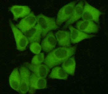 Anti-FASN / Fatty acid synthase, clone 6B9-H12-E7