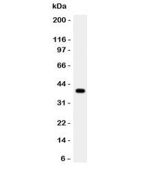 Anti-Cathepsin G