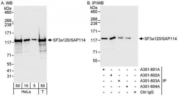 Anti-SF3a120/SAP114