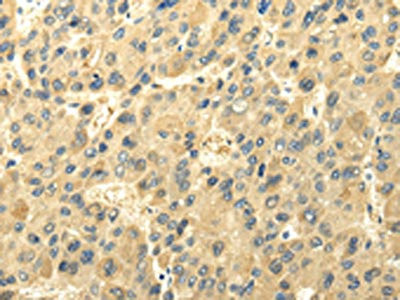 Anti-UGT1A6