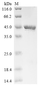 Contig An12c0300, genomic contig (An12g08930), Aspergillus niger, recombinant