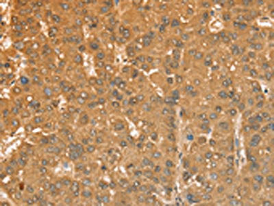 Anti-CXCR4