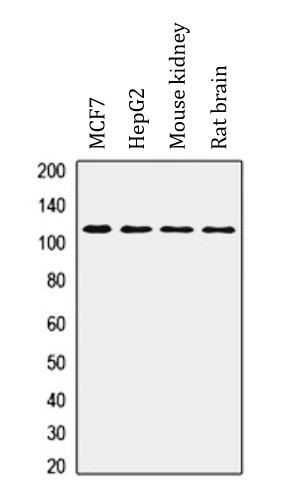 Anti-PKD2 / Polycystin 2