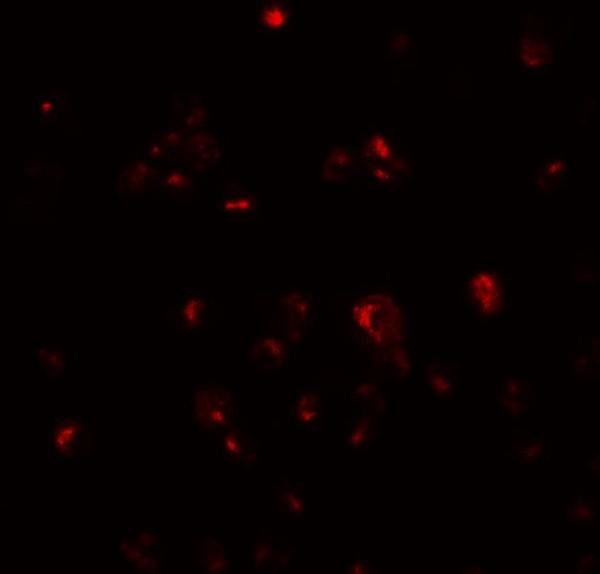 Anti-TDGF1 / Cripto 1