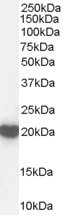 Anti-Peroxiredoxin 2, C-terminal