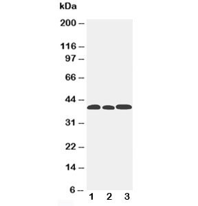 Anti-CCR5