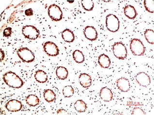 Anti-COL1A1 Monoclonal