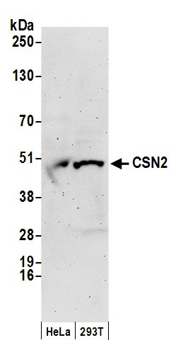 Anti-CSN2
