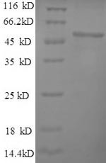 60S ribosomal protein L15 (RPL15), human, recombinant
