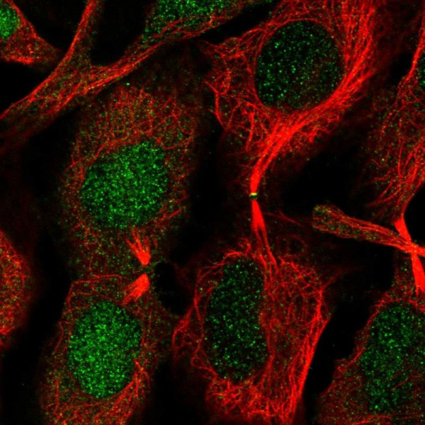 Anti-CHMP1B