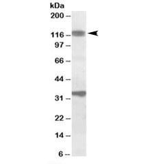 Anti-CCAR1