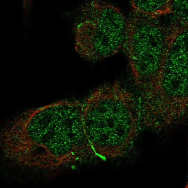 Anti-CDH10