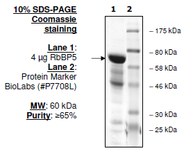 RbBP5, human recombinant protein, N-terminal His tag