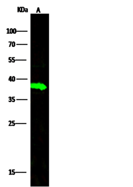 Anti-Carbonic Anhydrase VIII/CA8 Monoclonal Recombinant Antibody