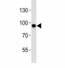 Anti-Sirt1