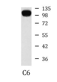 Anti-Hexokinase II, clone 1E8-H3-F11