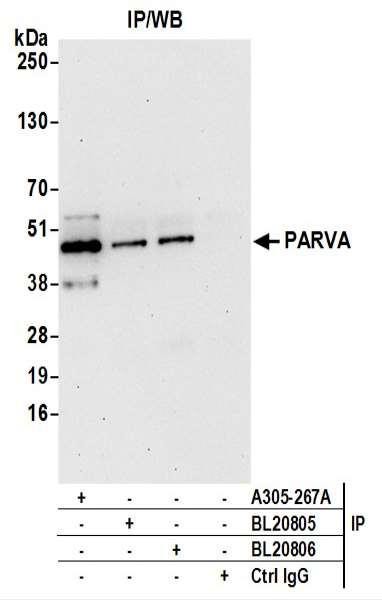 Anti-PARVA/Parvin alpha