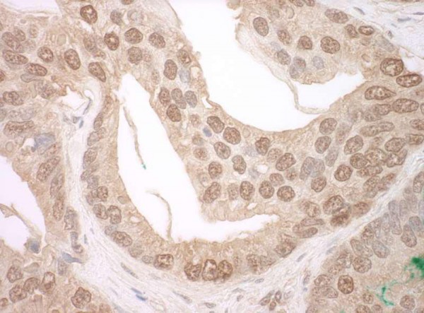 Anti-TFIP11 (IHC)