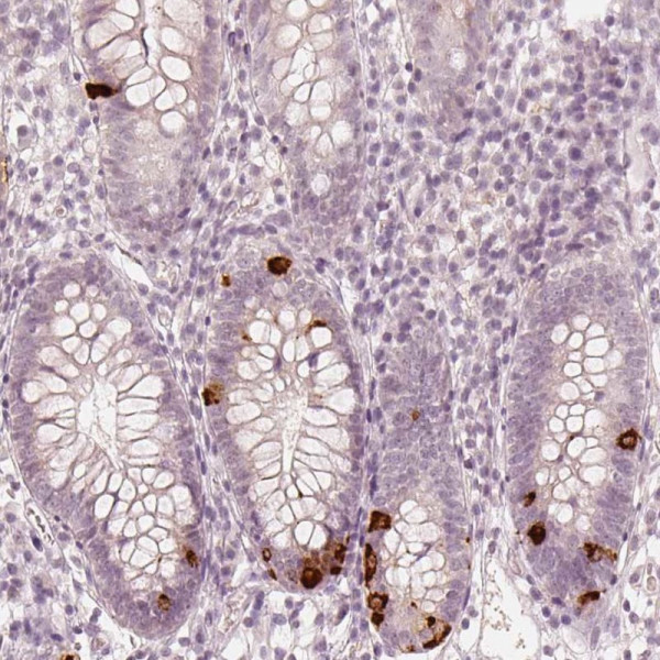 Anti-NPSR1