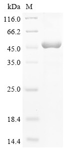 N-myc-interactor (NMI), partial, human, recombinant