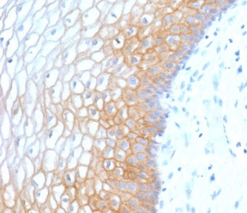 Anti-E-Cadherin / CDH1, clone ECD1-3R