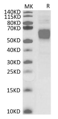 Fc gamma RI/CD64, His &amp; Avi, Human
