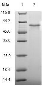 Apoptosis facilitator Bcl-2-like protein 14 (BCL2L14), human, recombinant