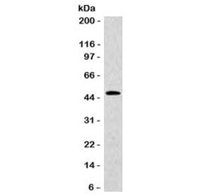Anti-Cytokeratin 20 / CK20, clone CTKN20-1
