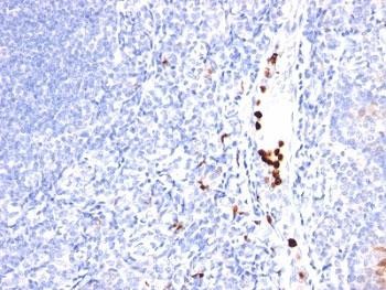 Anti-GCSF (Granulocyte-Colony Stimulating Factor), clone SPM468