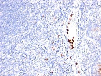 Anti-GCSF (Granulocyte-Colony Stimulating Factor), clone SPM468