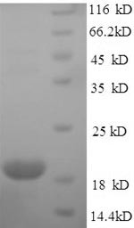 Immunoglobulin-like domain-containing receptor 2 (ILDR2), partial, human, recombinant