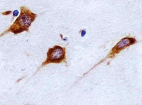 Anti-FAM120A, clone 1501CT803.19.85.5