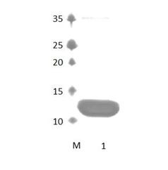 DFNB31_1 PDZ Domain
