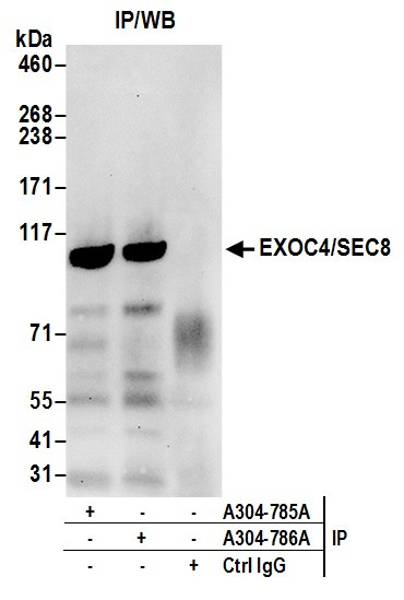 Anti-EXOC4/SEC8