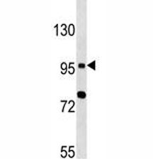 Anti-TLR6