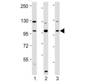 Anti-VAV2 (N-Terminal Region)