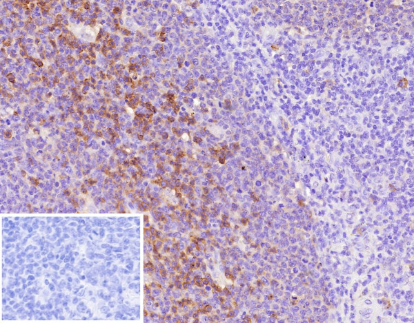 Anti-CD38 (ADP Ribosyl Cyclase I), clone CD38/9333