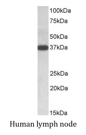 Anti-IDH3A