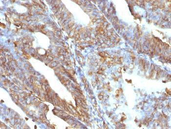 Anti-Vimentin (Mesenchymal Cell Marker) Monoclonal Antibody (Clone: V9)