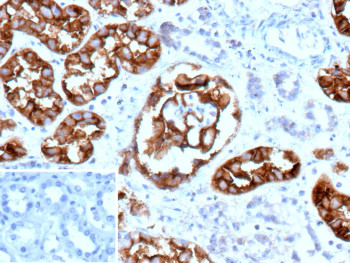 Anti-CD10 / Membrane metalloendopeptidase / MME, clone MME/12800R