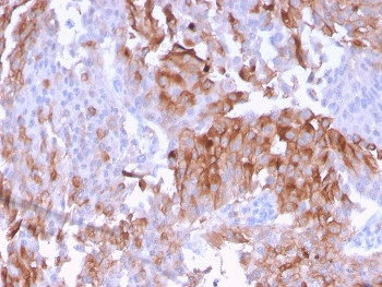 Anti-Uroplakin 1B / UPK1B, clone UPK1B/3102
