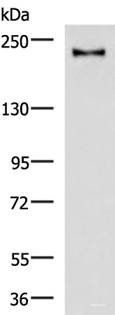 Anti-KIF21B