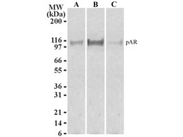 Anti-Androgen Receptor, clone 156C135.2