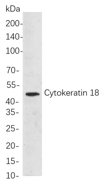 Anti-Recombinant Cytokeratin 18, clone 5F6