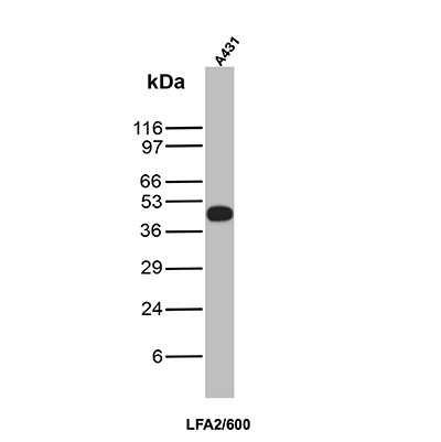 Anti-CD2 / Lymphocyte Function Antigen 2 (LFA-2), clone LFA2/600