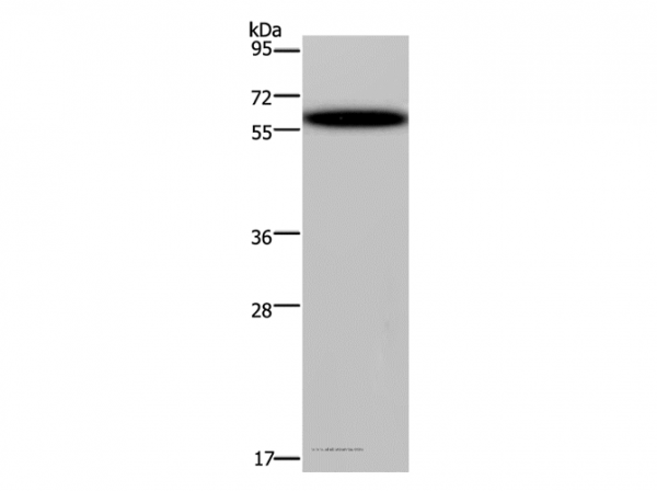 Anti-DDX19B
