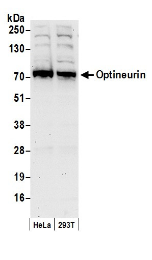 Anti-Optineurin